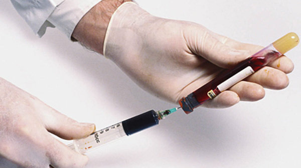 Фото: http://vsemlekarstva.ru