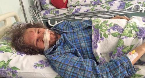 Андрей Рудомаха после нападения. Фото предоставлено "Кавказскому узлу" Михаилом Абрамяном Андрей Рудомаха после нападения. Фото предоставлено "Кавказскому узлу" Михаилом Абрамяном