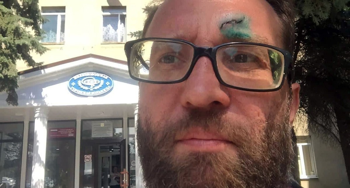 Активист Андрей Фокин. Фото Андрея Фокина - странциа FB  https://www.facebook.com/photo.php?fbid=2872852506118095&set=a.877961962273836&type=3&theater
