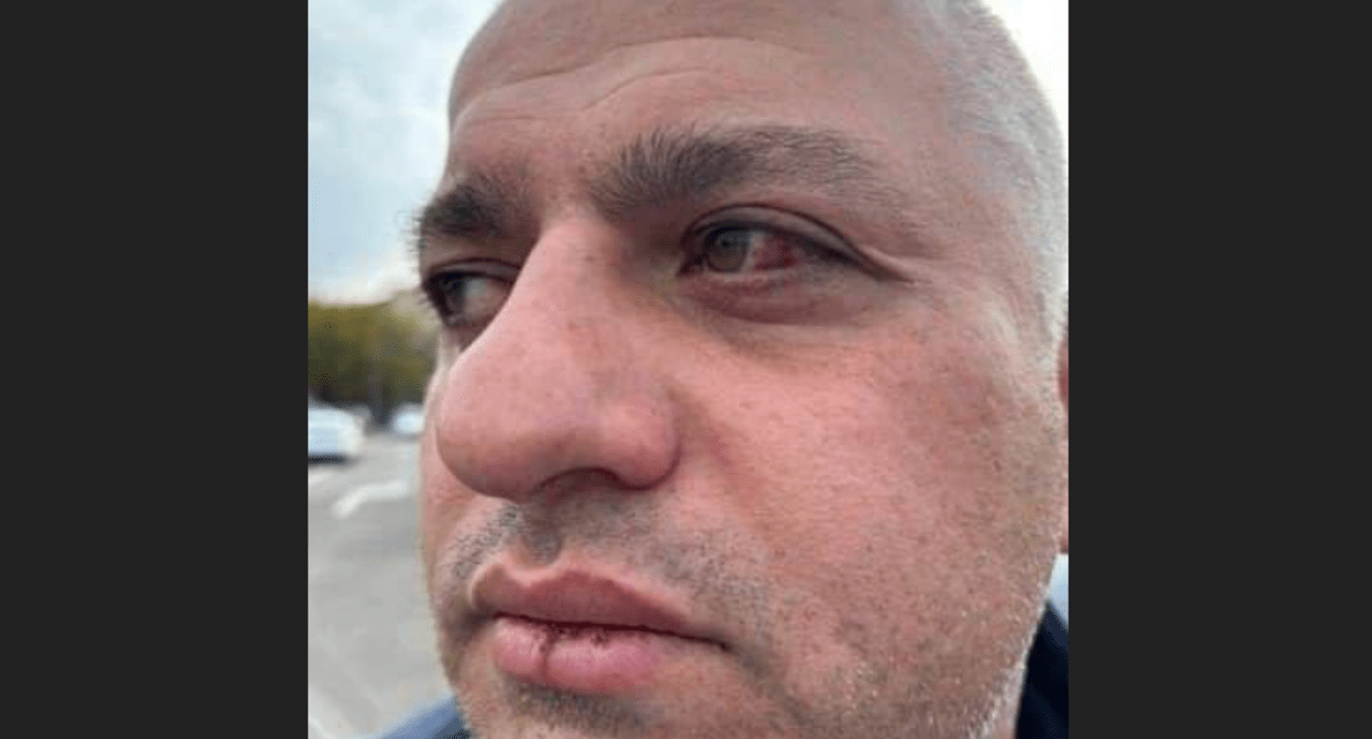 Барамидзе после избиения силовиками. Скриншот фото Tbilisi Life от 19.11.24, https://t.me/Tbilisi_life/31349