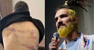 Артемий Останин со следами побоев после задержания и ранее на сцене. Фото: https://t.me/Merkacheva/3467, Telegram-канал 