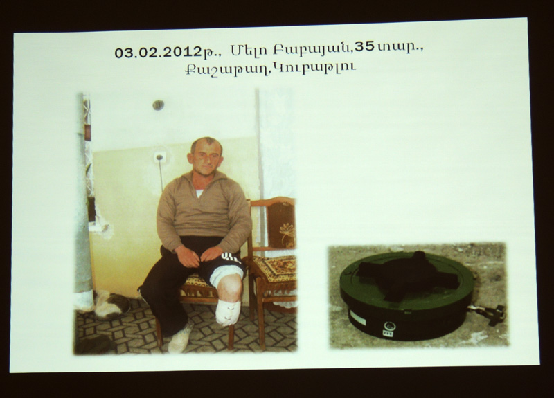 Жертва противопехоьной мины. Жертва противопехоьной мины.